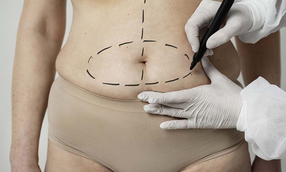 what results can be expected from non-invasive body contouring procedures